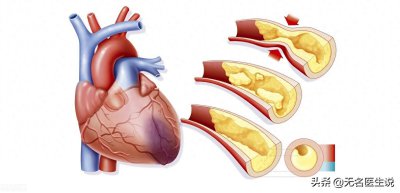 ​冠心病的解剖基础-最全的冠脉血管图解