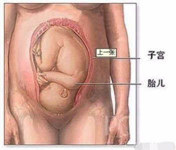 ​剖腹产手术全过程图解，需要切开7层才能将宝宝取出