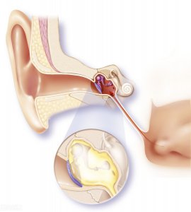 ​中耳炎症状有哪些表现形式（中耳炎有哪些症状表现形式？都有什么危害，会影响