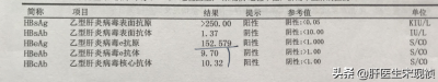 ​小三阳严重吗 不止要检查乙肝两对半，你还需要了解这些